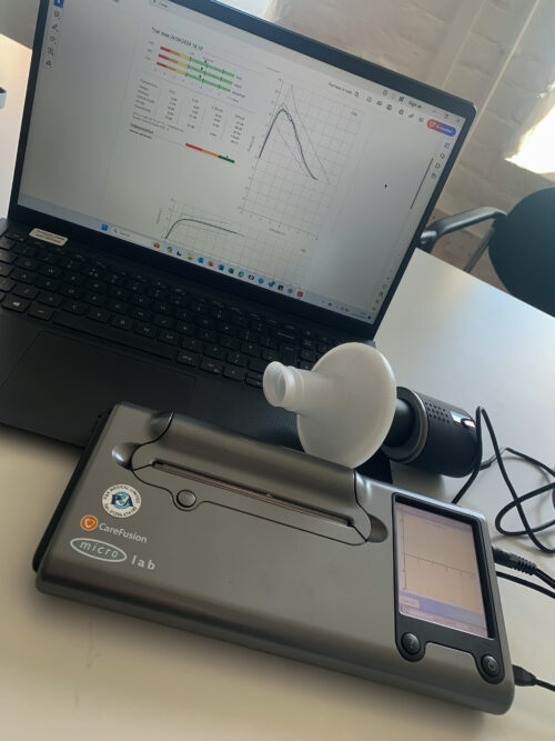 A spirometer machine and a laptop with graphs of results